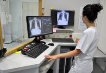 Radiologia più performante grazie al nuovo apparecchio in dotazione al CSVP